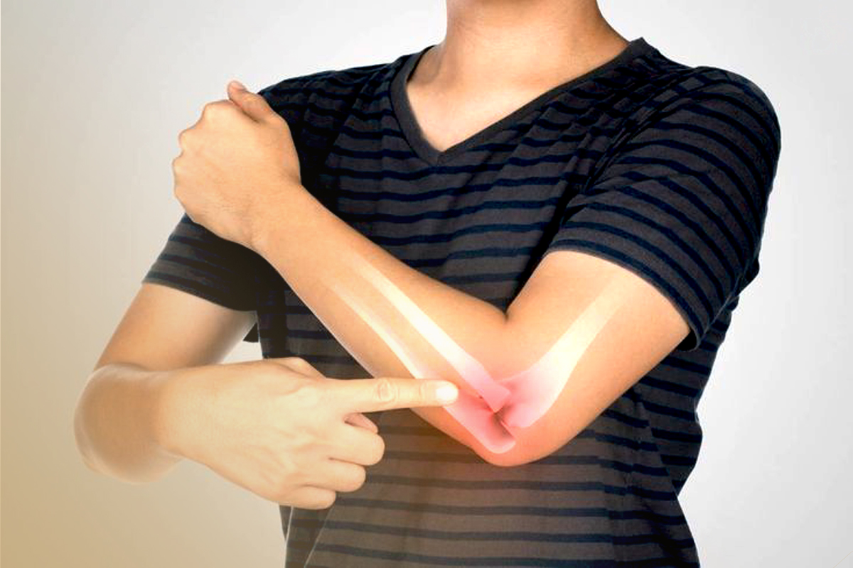 شکستگی استخوان و همه چیز درمورد آن